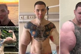 'Russian Popeye' who injected oil into biceps hospitalised after health fears
