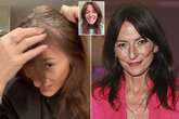 Davina McCall shows off brain surgery scar as she has first haircut since operation