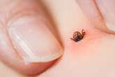 First case of fatal tick-borne virus detected as it 'buries itself in the brain'