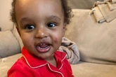 'Doctors said my baby's rash was ringworm and TB – only one thing finally cured it'