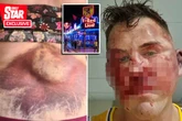 Hundreds of Brits randomly beaten up by knuckle duster-armed Benidorm bouncers, group claims