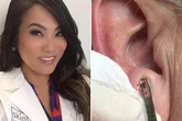 Dr Pimple Popper yanks something that is 'not an earring' out of earlobe