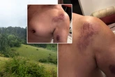 Man 'attacked by a leopard' walking in English countryside and beast left claw marks