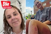 Nurse almost burns to death after freak gust of wind sets her and house on fire