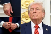 All we know about Trump health tests detailing swollen ankles and hand mark