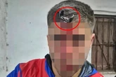 Footballer has car key jammed into his head in fight at underage girl's match