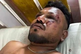Small detail in Brit Air India plane crash survivor's memory could solve mystery