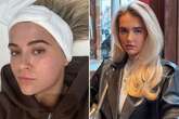 Molly-Mae Hague horrified as she grows 'full beard' due to beauty treatment side effect