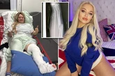 Adult stars' horror accidents - Emily Willis tragedy to Angela White's 'pummelled' nightmare
