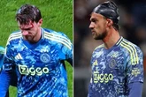 Europa League star suffers horror injury and is patched up using swimming cap