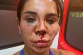 Beauty influencer disfigured after being tied up and attacked with bleach in terrifying raid