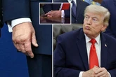 Donald Trump sparks frantic health debate as certain body part leaves people transfixed