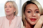 Leslie Ash unveils facelift results and looks '10 years younger' after years of insecurity