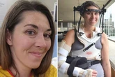 'Decapitated' woman saved after horror football injury as head screwed back on