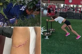 'Superwoman' sport star shocks fans with horror pic – 'blessed I still have leg'