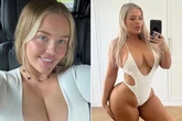 Adult model 'almost died' after botched BBL in Turkey left her 'vomiting blood'