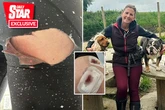 Horror as marathon runner's training jog ends in bloodbath after dog bites bum