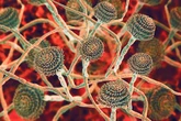 Superbug fungus that could eat you from the inside out is spreading fast and could soon reach UK