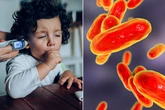 Contagious 100-day cough has 'worst outbreak for 40 years' as doctors issue stark warning