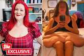 'I lost 33 stone but the excess skin I was left with made me feel ashamed'