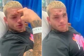 MMA fighter rushed to hospital with dent so deep he can put finger his in it