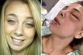 Woman who gouged her eyes out on meth sees the light and goes back to school