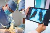 Surgeon appears to 'catch rare cancer from patient' after it 'latched onto wound'