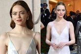 Emma Stone in naked shower incident as she suffers horror injury to sensitive body part
