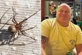 Brit bloke catches flesh-eating disease from tiny spider bite before jetting off on hols