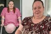 Woman with 'biggest hernia doctors ever saw' stuck living 17-year 'nightmare'