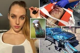 Adult star driver nearly killed by psycho pigeon gives horror 'memory loss' update