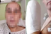 Pipe bomb moron dubs himself 'Captain Hook' after blowing his own hand off