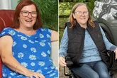 Gogglebox star left with 'irreversible' brain damage after losing sight while driving