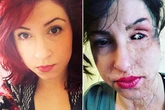 Mum-of-three had half her face burned off in horror acid attack by ex-boyfriend