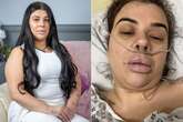 Woman's botched £5k 'mummy makeover' left her with just one boob – and it stank