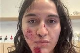 Horror as mad magpie attacks woman and leaves her with broken neck