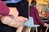 Cruise passenger scrapes dry skin off foot then scoffs pizza using same hand