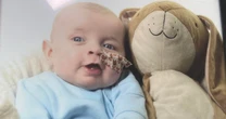 Parents plea for treatment as baby is 'only one in UK with fatal rare condition'
