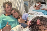 Stag party reveller fights off hyenas who tried to eat him after crashing out in tent