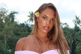 Model couldn't sit down after two horror 'botched' BBLs – but is still going back under knife