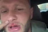 'Britain's hardest man' was 'punched by rival' as Tyson Fury's brother caught up in row