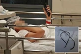 Teen's kidney explodes after doctor 'leaves something inside him' after surgery