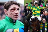 Cheltenham winner nearly lost an eye when he was kicked in the face by a foal