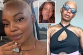 Mystery deadly rash left woman's skin peeling off 'like something out of a horror film'