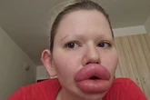 'I have the biggest lips in the world - I see myself as some kind of lego project'