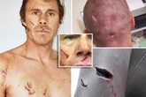 'A great white shark swallowed me – I was stuck down the back of its throat'