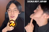 Bloke claims to have 'world’s longest chin' as doctors puzzled by growth spurt