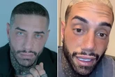 Reality star who had risky eye colour change wants even wilder op that's banned in EU