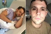Party animal almost killed by 5-day cocaine bender which left him with 'devil eyes'