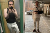 Man with 'world's biggest willy' breaks arm in shower as huge todger 'got in the way'